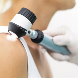 Скрининг - дерматоскопия в рамках врачебного приема до 3 новообразований - alwento.ru – Екатеринбург