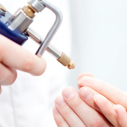 Криодеструкция бородавок, папиллом, остроконечных кондилом, контагиозного моллюска до 0.5 см до 5 штук - alwento.ru – Екатеринбург